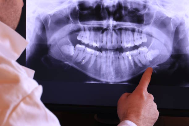 Best Emergency Treatment for Toothache in Spring Hope, NC